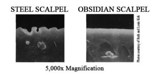 obsidian scalpel dangers obsidian scalpel dangers